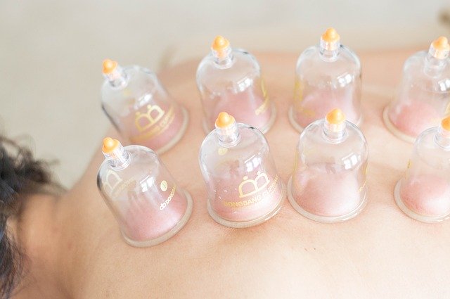 Cupping Los Angeles, CA
